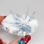 Frostbite